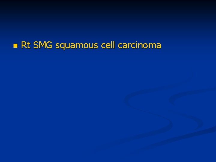 n Rt SMG squamous cell carcinoma 
