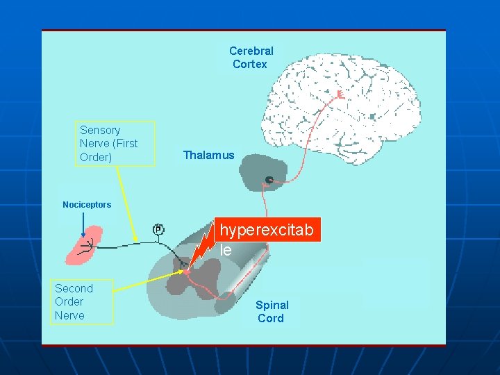 Cerebral Cortex Sensory Nerve (First Order) Thalamus Nociceptors hyperexcitab le Second Order Nerve Spinal