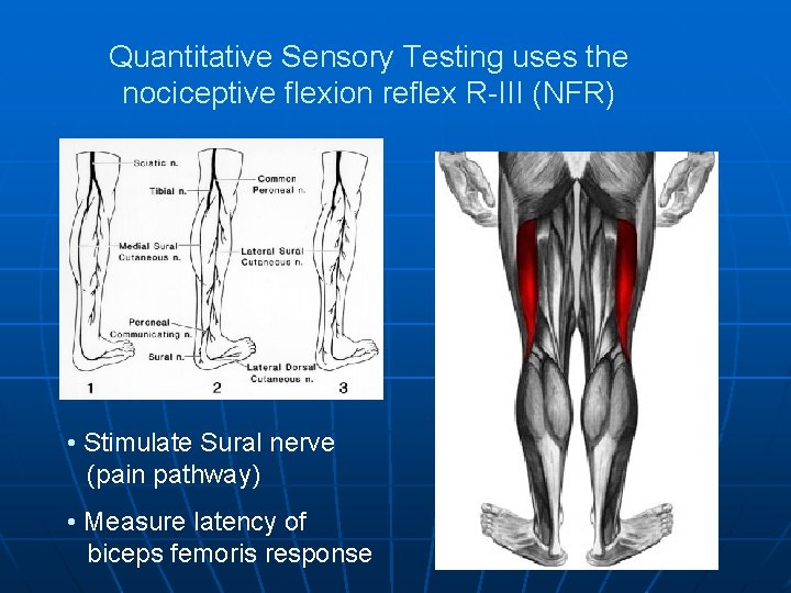 Quantitative Sensory Testing uses the nociceptive flexion reflex R-III (NFR) • Stimulate Sural nerve