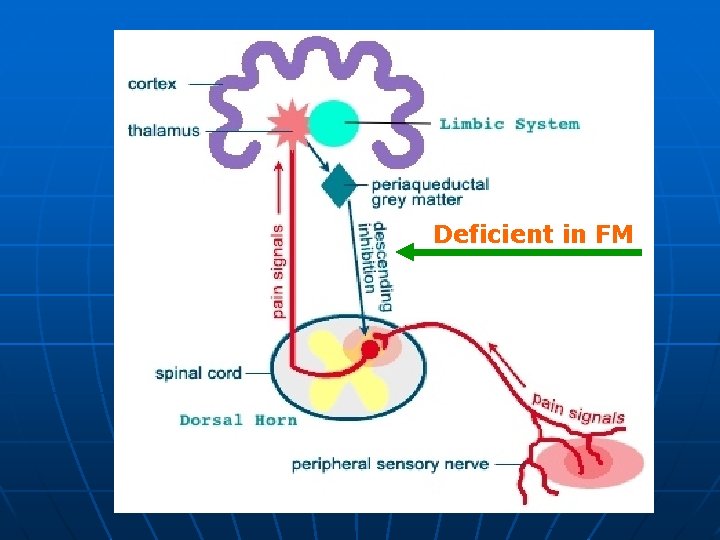 Deficient in FM 