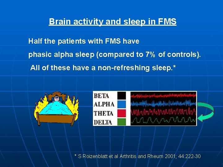 Brain activity and sleep in FMS Half the patients with FMS have phasic alpha