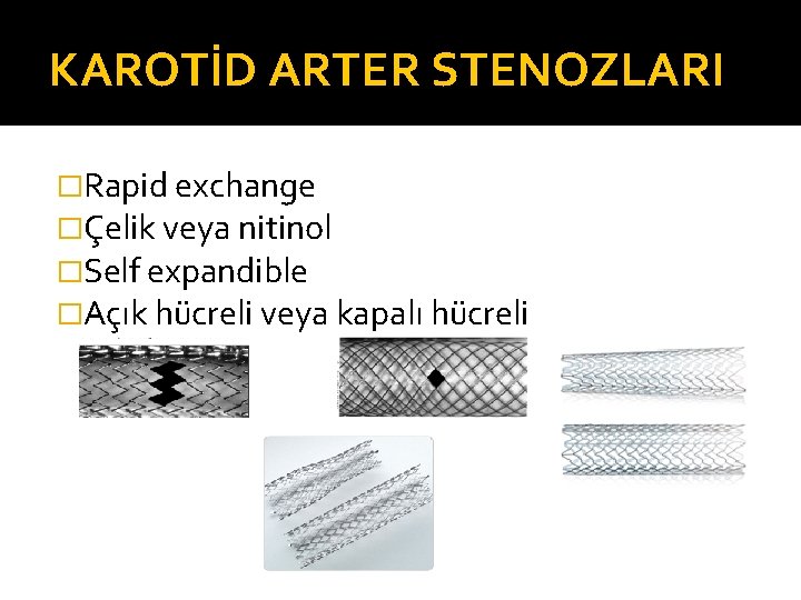 KAROTİD ARTER STENOZLARI �Rapid exchange �Çelik veya nitinol �Self expandible �Açık hücreli veya kapalı