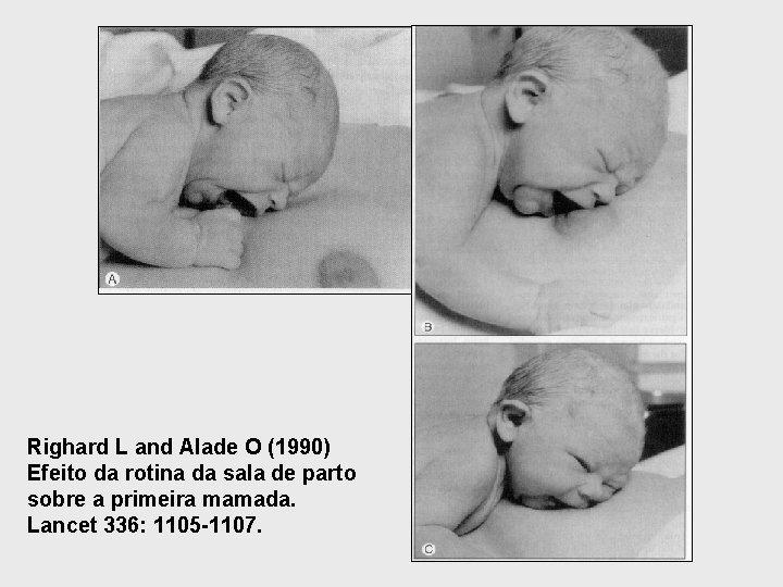 Righard L and Alade O (1990) Efeito da rotina da sala de parto sobre