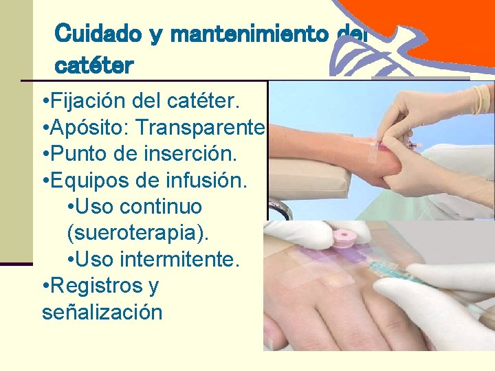 Cuidado y mantenimiento del catéter • Fijación del catéter. • Apósito: Transparente • Punto