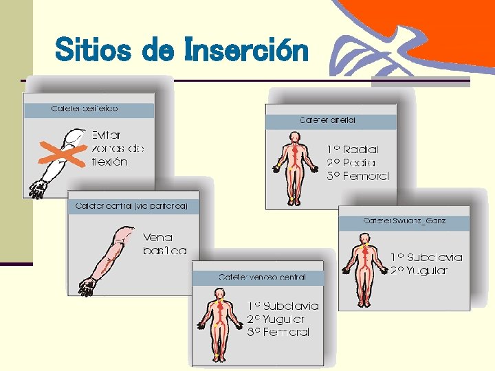Sitios de Inserción 