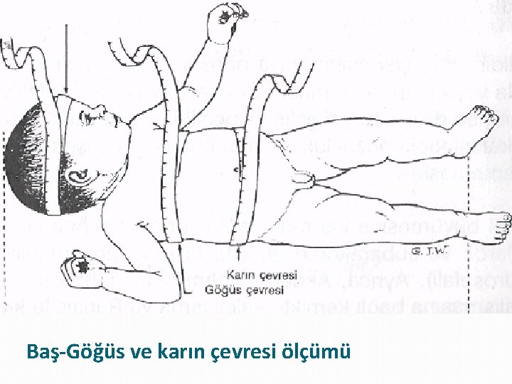 Baş-Göğüs ve karın çevresi ölçümü 