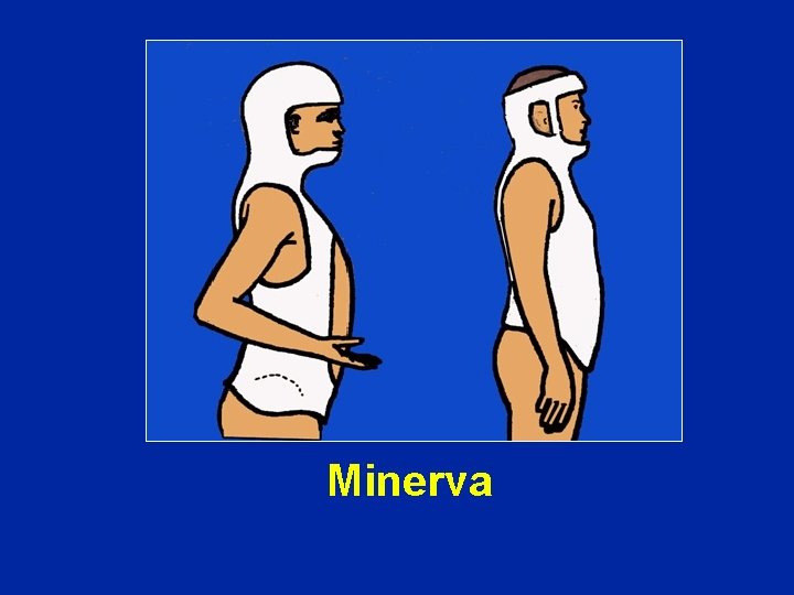 Minerva 