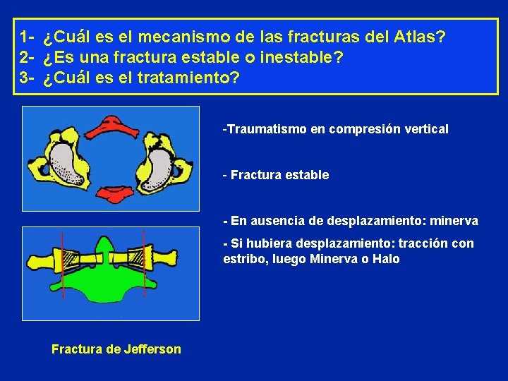 1 - ¿Cuál es el mecanismo de las fracturas del Atlas? 2 - ¿Es