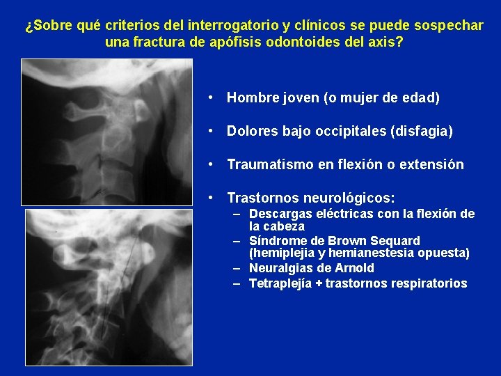 ¿Sobre qué criterios del interrogatorio y clínicos se puede sospechar una fractura de apófisis
