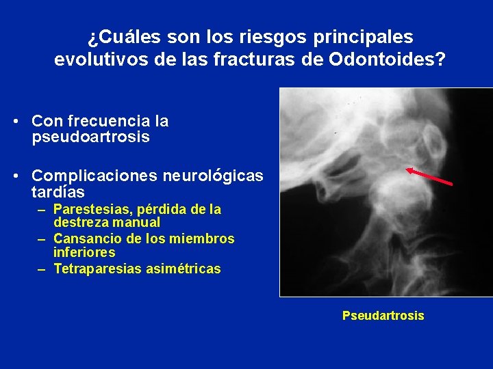 ¿Cuáles son los riesgos principales evolutivos de las fracturas de Odontoides? • Con frecuencia