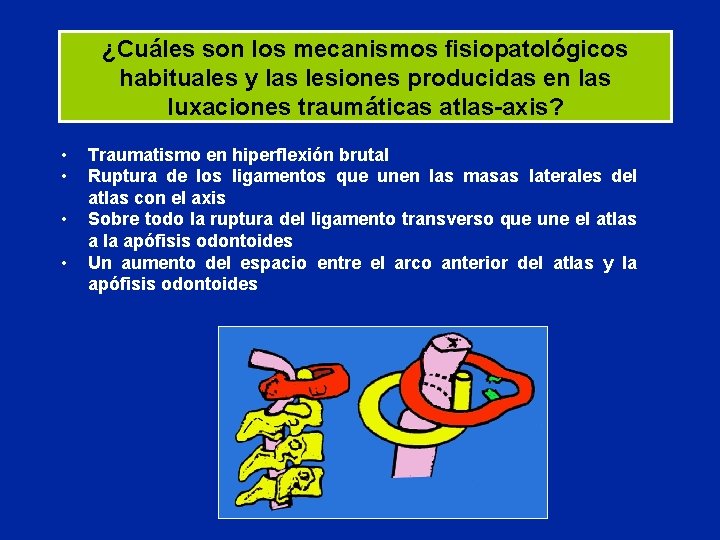 ¿Cuáles son los mecanismos fisiopatológicos habituales y las lesiones producidas en las luxaciones traumáticas