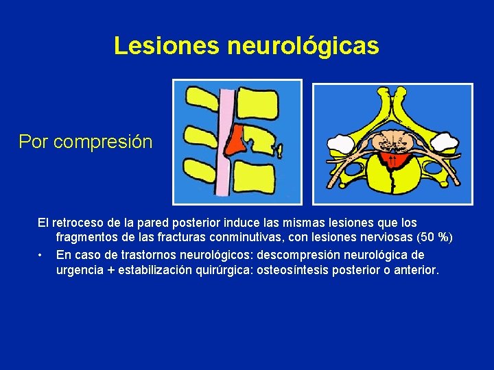 Lesiones neurológicas Por compresión El retroceso de la pared posterior induce las mismas lesiones