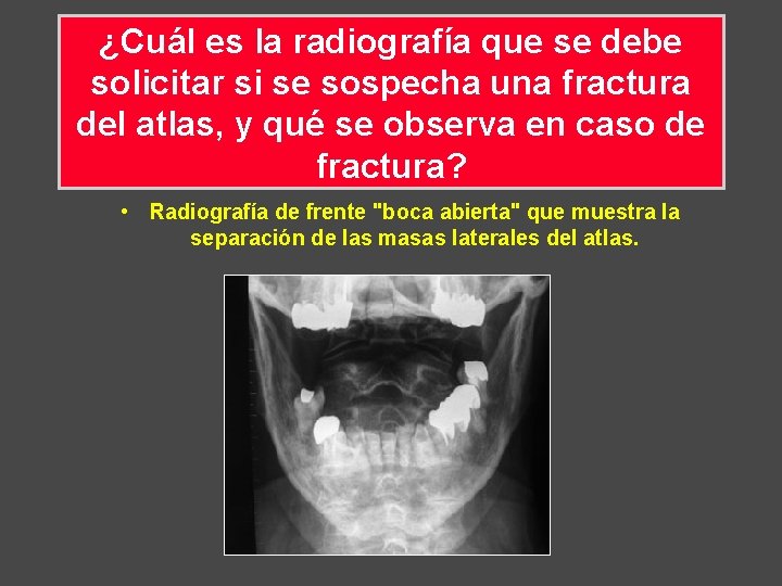 ¿Cuál es la radiografía que se debe solicitar si se sospecha una fractura del