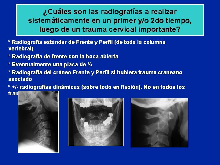 ¿Cuáles son las radiografías a realizar sistemáticamente en un primer y/o 2 do tiempo,