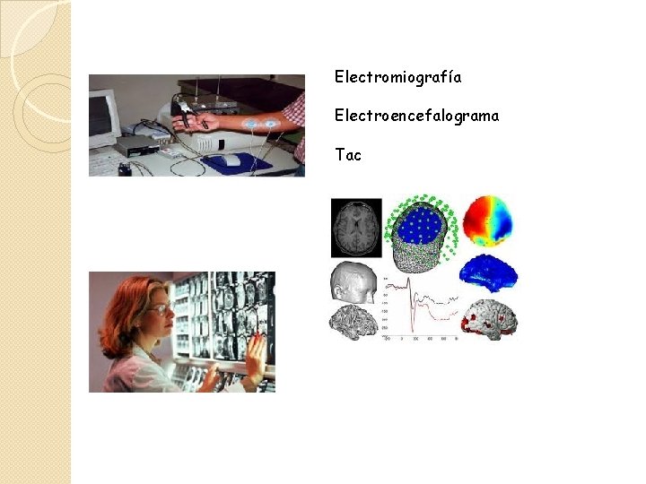 Electromiografía Electroencefalograma Tac 