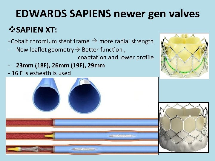 EDWARDS SAPIENS newer gen valves v. SAPIEN XT: -Cobalt chromium stent frame more radial