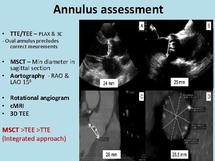 Annulus assessment TTE TEE • TTE/TEE – PLAX & 3 C - Oval annulus