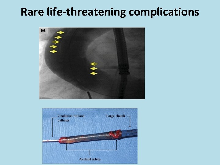 Rare life-threatening complications 