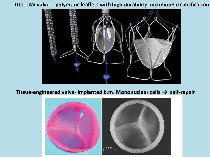 UCL-TAV valve - polymeric leaflets with high durability and minimal calcification Tissue-engineered valve- implanted