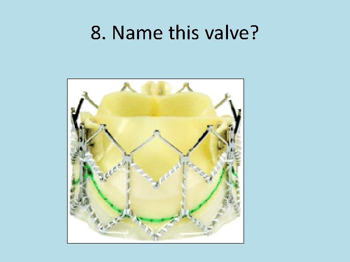 8. Name this valve? 