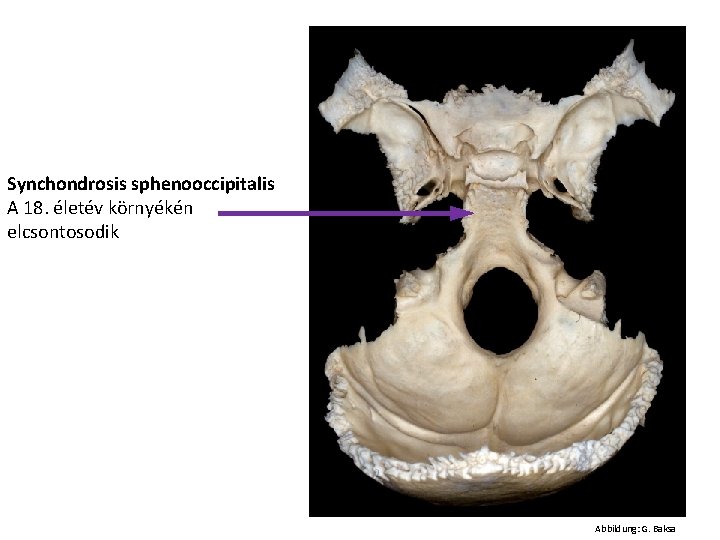 Synchondrosis sphenooccipitalis A 18. életév környékén elcsontosodik Abbildung: G. Baksa 