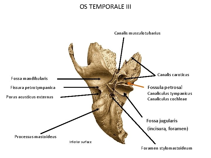 OS TEMPORALE III Canalis musculotubarius Canalis caroticus Fossa mandibularis Fossula petrosa! Fissura petrotympanica Canaliculus