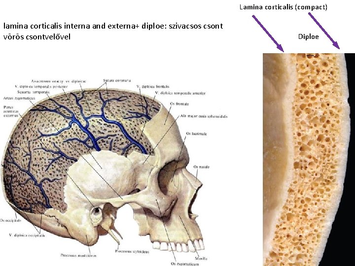 Lamina corticalis (compact) Diploe } lamina corticalis interna and externa+ diploe: szivacsos csont vörös