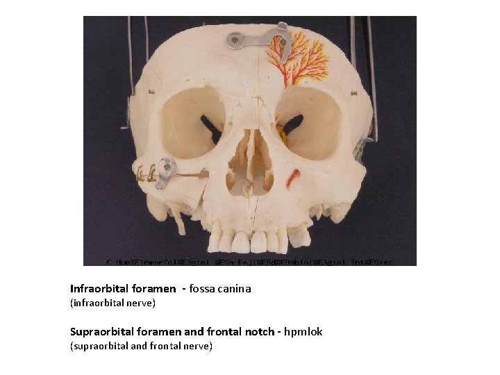 Infraorbital foramen - fossa canina (infraorbital nerve) Supraorbital foramen and frontal notch - hpmlok