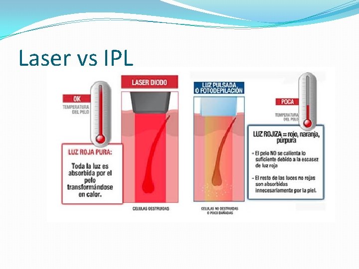 Laser vs IPL Laser vs IPL