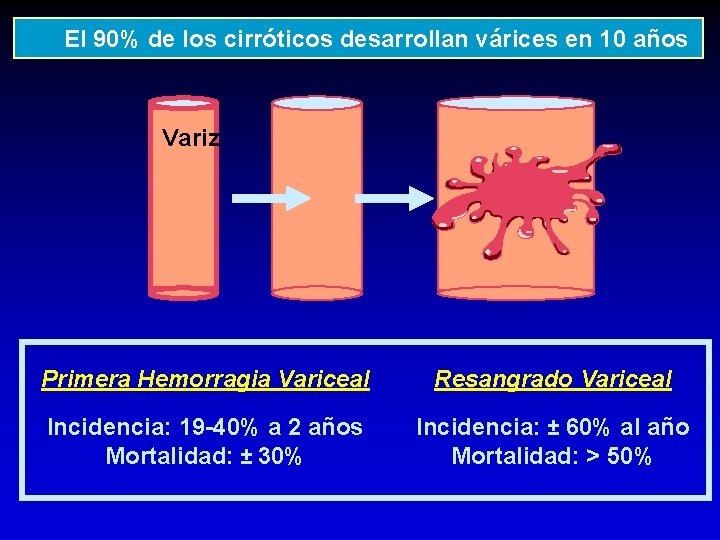 El 90% de los cirróticos desarrollan várices en 10 años Variz Primera Hemorragia Variceal