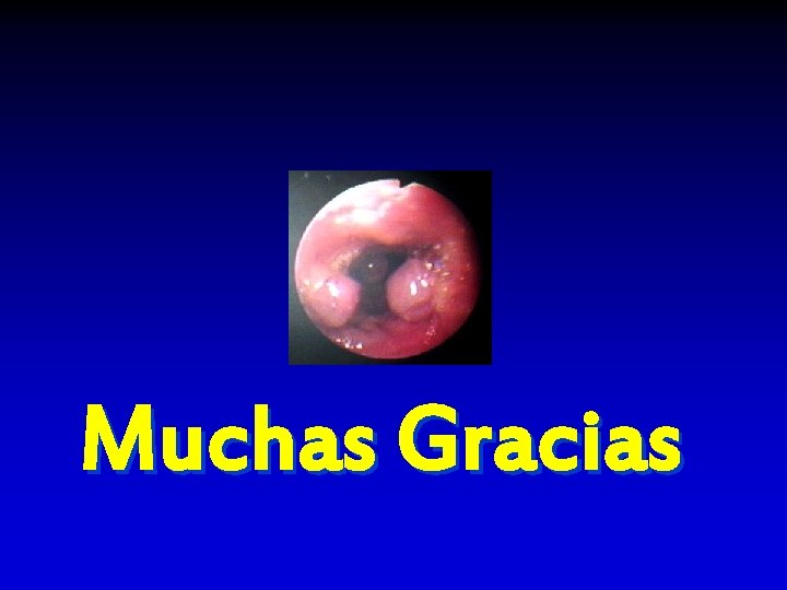 Muchas Gracias 