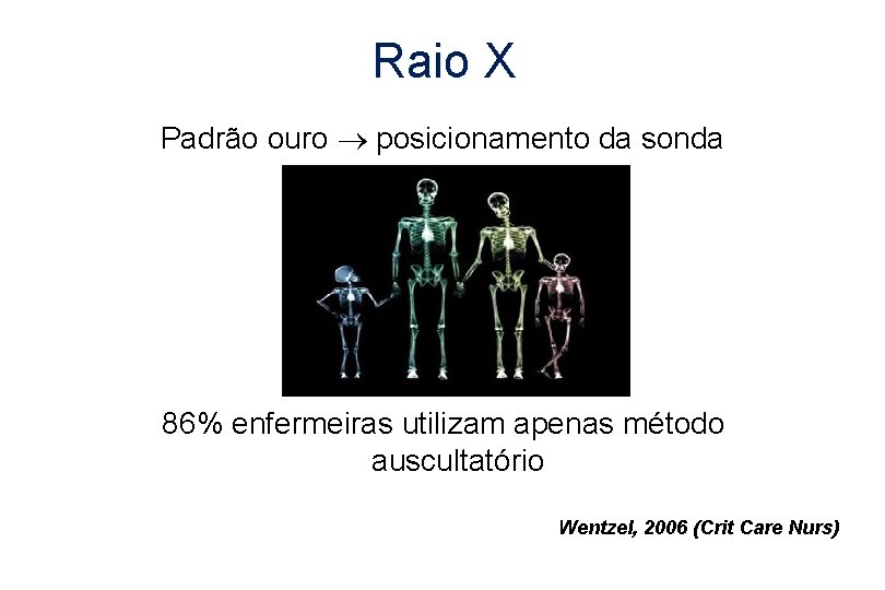 Raio X Padrão ouro posicionamento da sonda 86% enfermeiras utilizam apenas método auscultatório Wentzel,