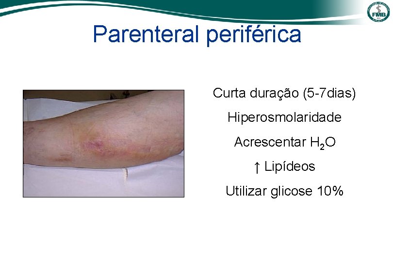 Parenteral periférica Curta duração (5 -7 dias) Hiperosmolaridade Acrescentar H 2 O ↑ Lipídeos