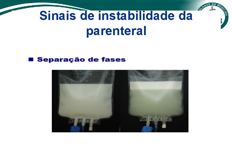 Sinais de instabilidade da parenteral 