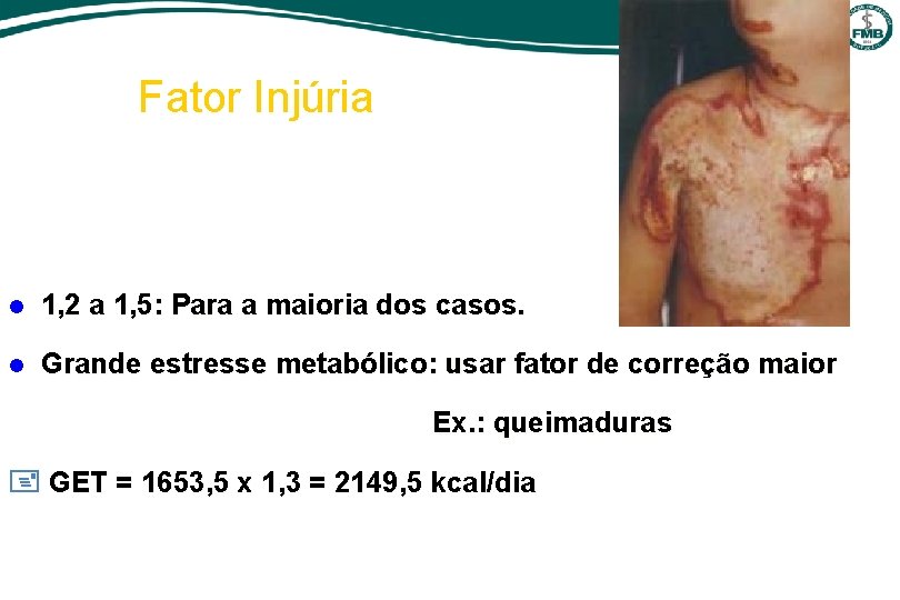 Fator Injúria l 1, 2 a 1, 5: Para a maioria dos casos. l