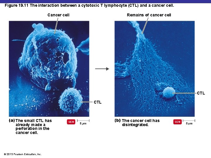 Chapter 19 Disorders Associated with the Immune System