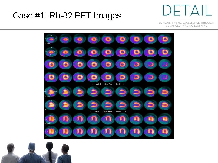 Case #1: Rb-82 PET Images 