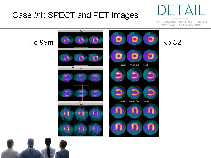 Case #1: SPECT and PET Images Tc-99 m Rb-82 