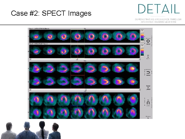 Case #2: SPECT Images Case #2: SPECT Images