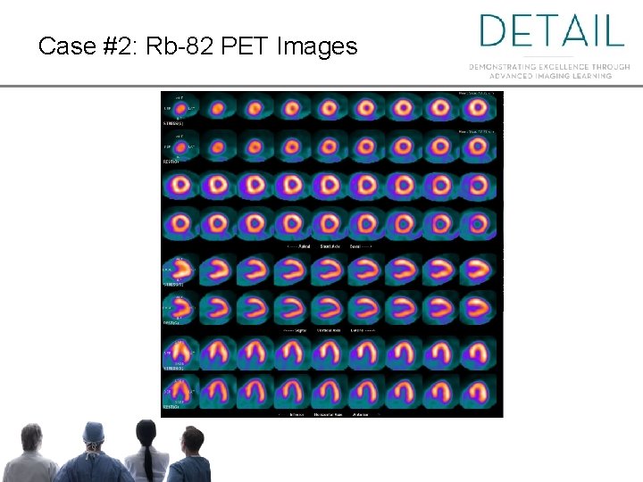 Case #2: Rb-82 PET Images 
