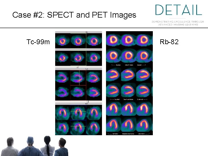 Case #2: SPECT and PET Images Tc-99 m Rb-82 