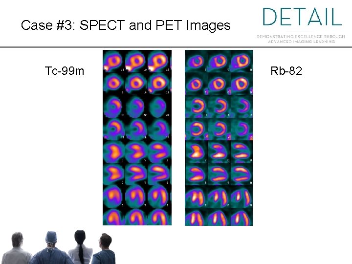 Case #3: SPECT and PET Images Tc-99 m Rb-82 Case #3: SPECT and PET Images Tc-99 m Rb-82