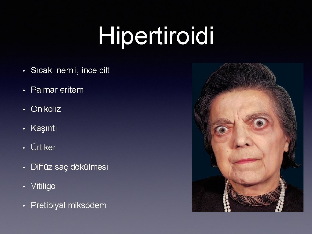 Hipertiroidi • Sıcak, nemli, ince cilt • Palmar eritem • Onikoliz • Kaşıntı •