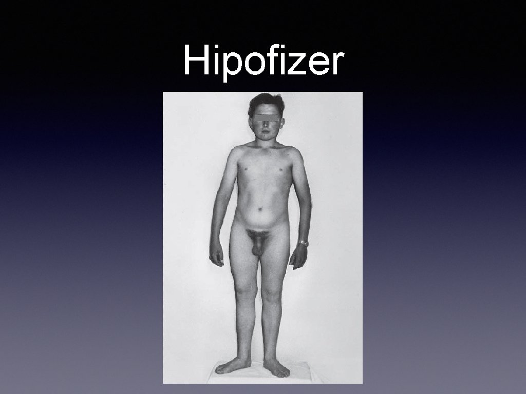 Hipofizer 