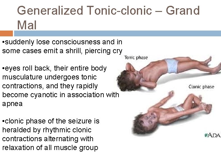 Generalized Tonic-clonic – Grand Mal • suddenly lose consciousness and in some cases emit