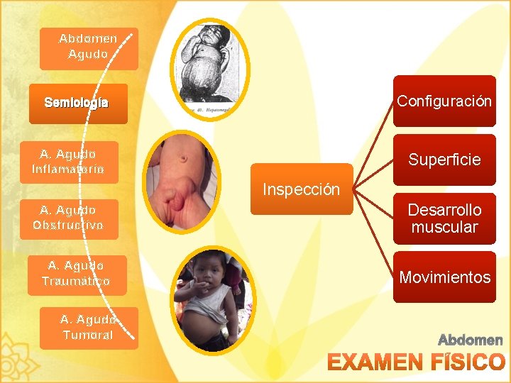 Abdomen Agudo Configuración Semiología A. Agudo Inflamatorio Superficie Inspección A. Agudo Obstructivo A. Agudo