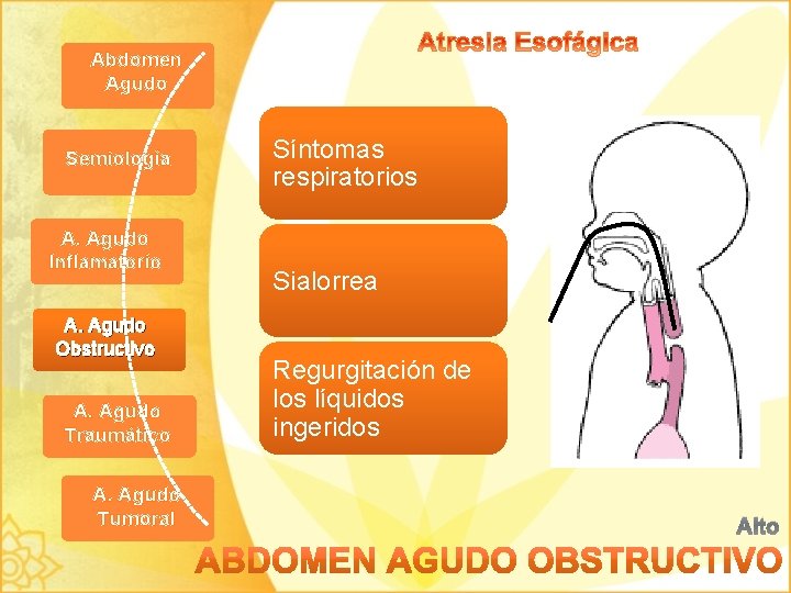 Abdomen Agudo Semiología A. Agudo Inflamatorio A. Agudo Obstructivo A. Agudo Traumático A. Agudo