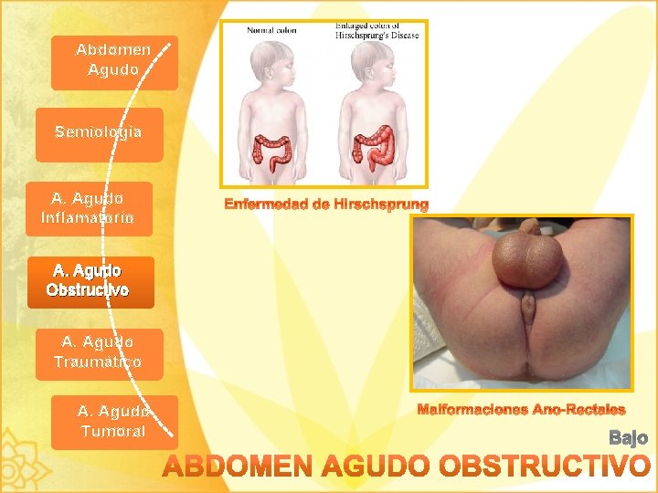 Abdomen Agudo Semiología A. Agudo Inflamatorio A. Agudo Obstructivo A. Agudo Traumático A. Agudo