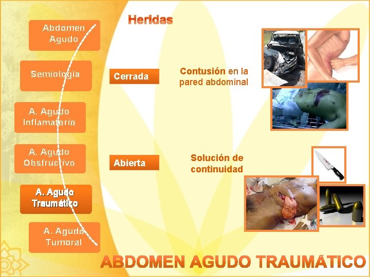 Abdomen Agudo Semiología Cerrada Contusión en la pared abdominal A. Agudo Inflamatorio A. Agudo