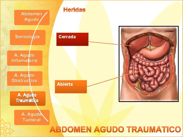 Abdomen Agudo Semiología Cerrada A. Agudo Inflamatorio A. Agudo Obstructivo A. Agudo Traumático A.